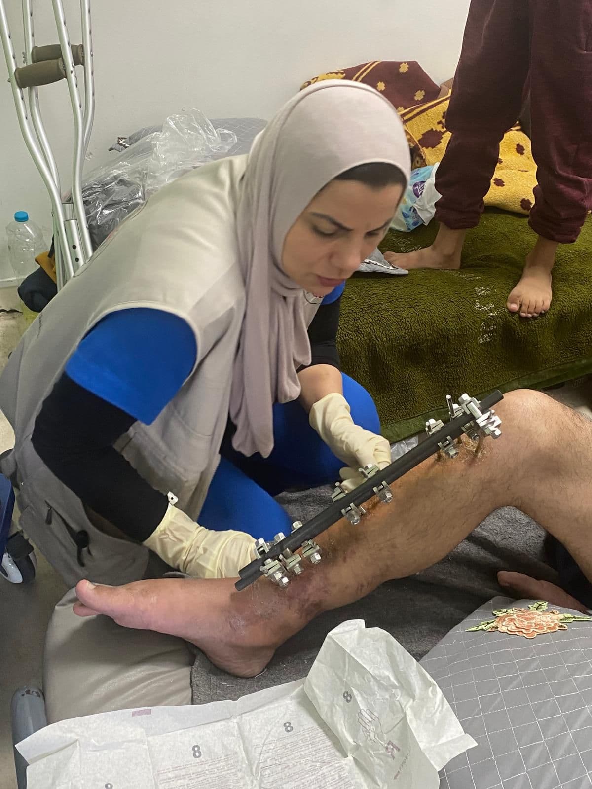Volunteer caring for a patient's leg fitted with an external fixator